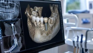 guided and robotic dental implants in greenacres, questions to ask before treatment