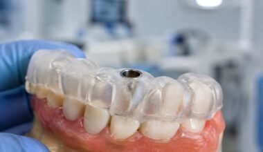 how dentists can build safer, more predictable dental implant workflows